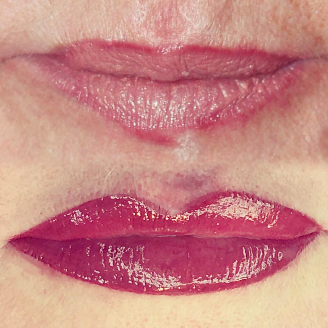 Permanent Lips before and after image