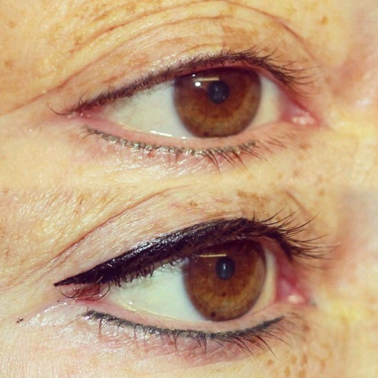 Permanent Eyes before and after image