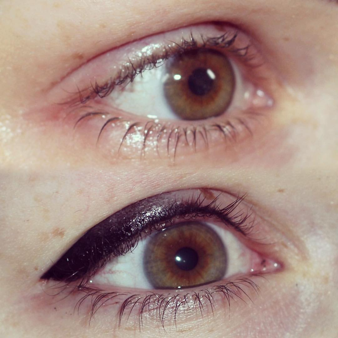 Permanent Eyes before and after image
