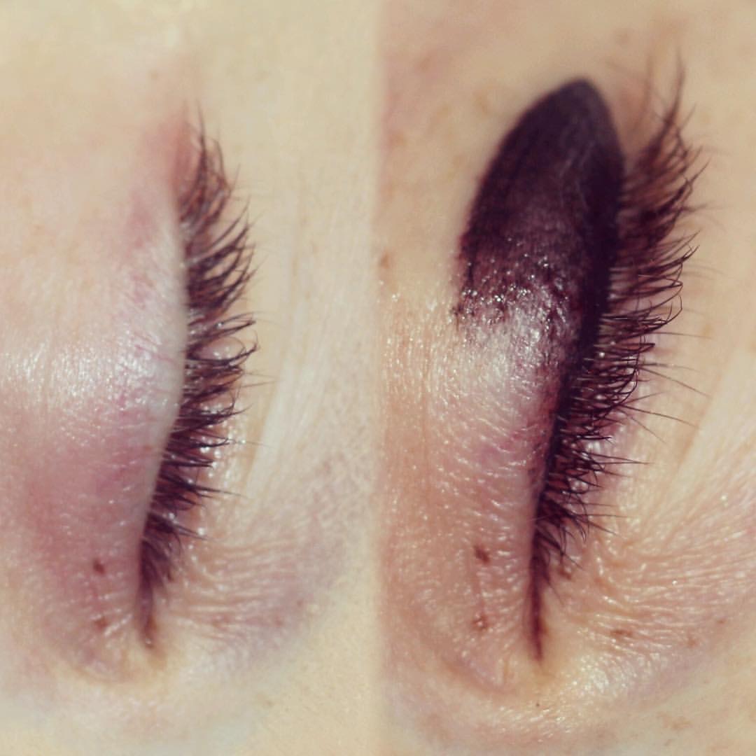 Permanent Eyes before and after image