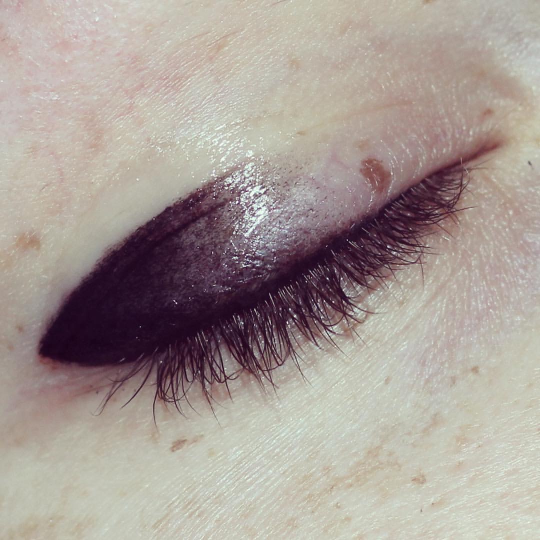 Permanent Eyes before and after image