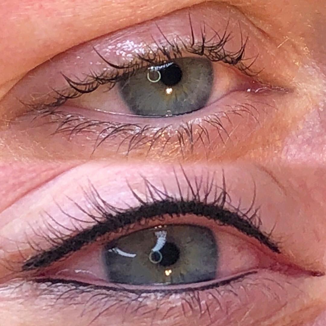 Permanent Eyes before and after image
