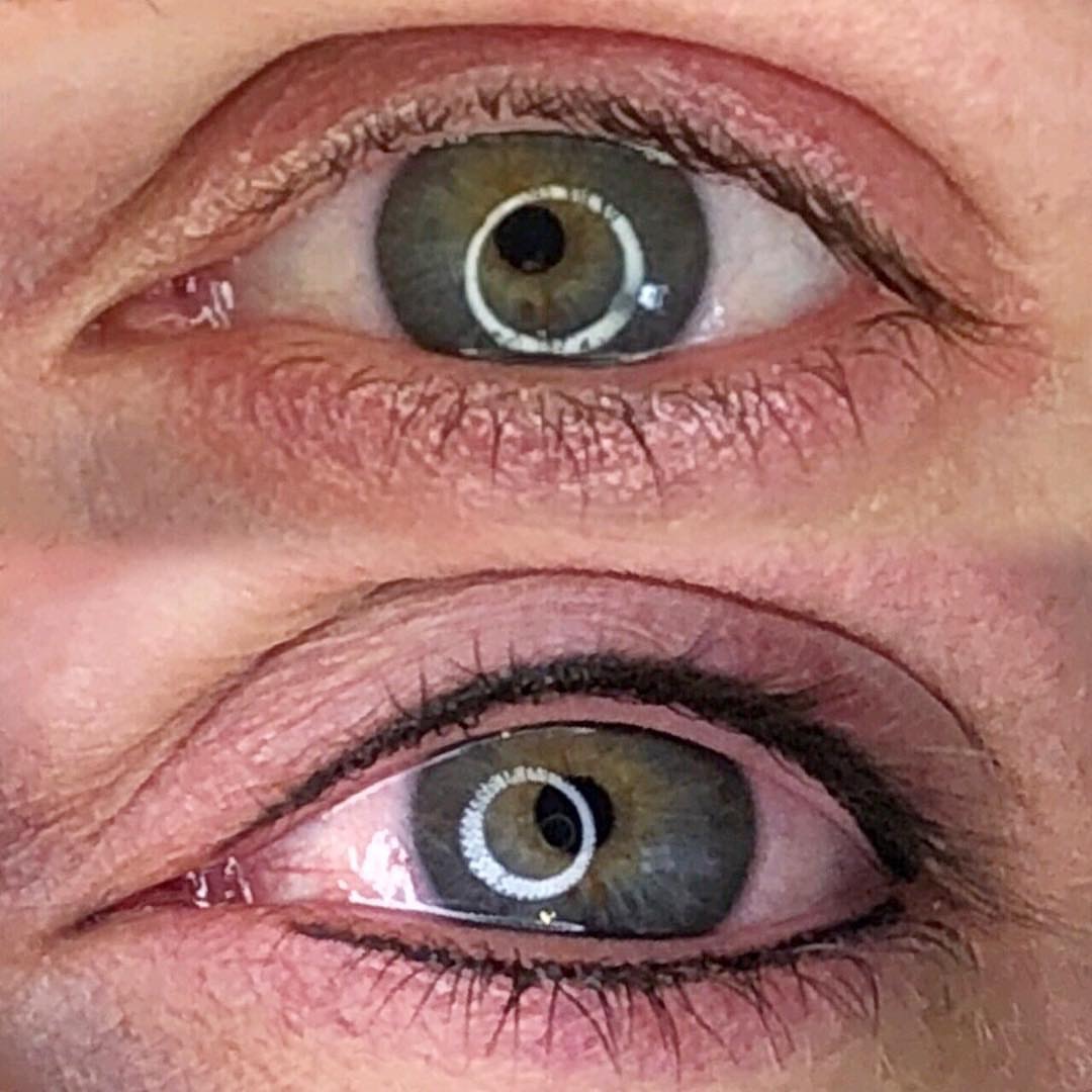 Permanent Eyes before and after image