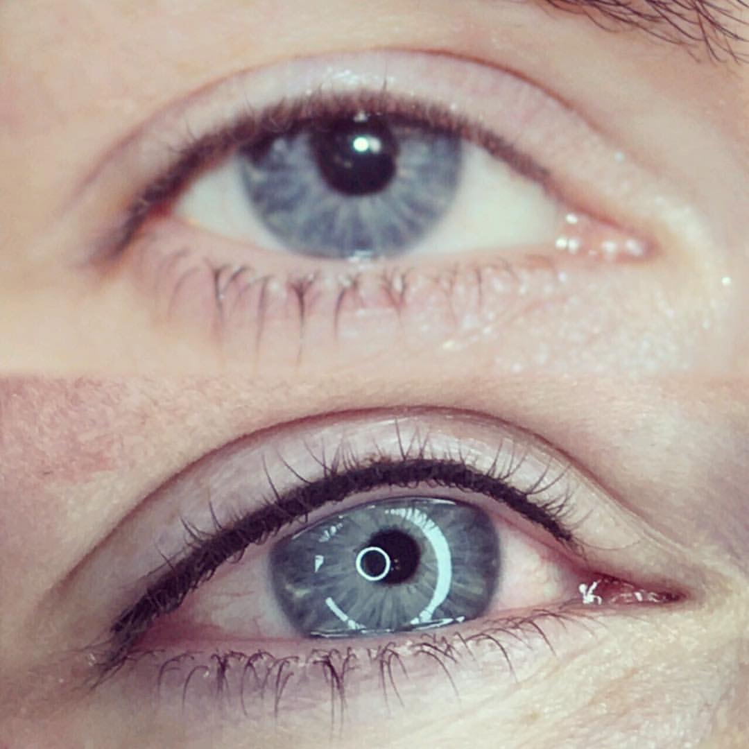 Permanent Eyes before and after image