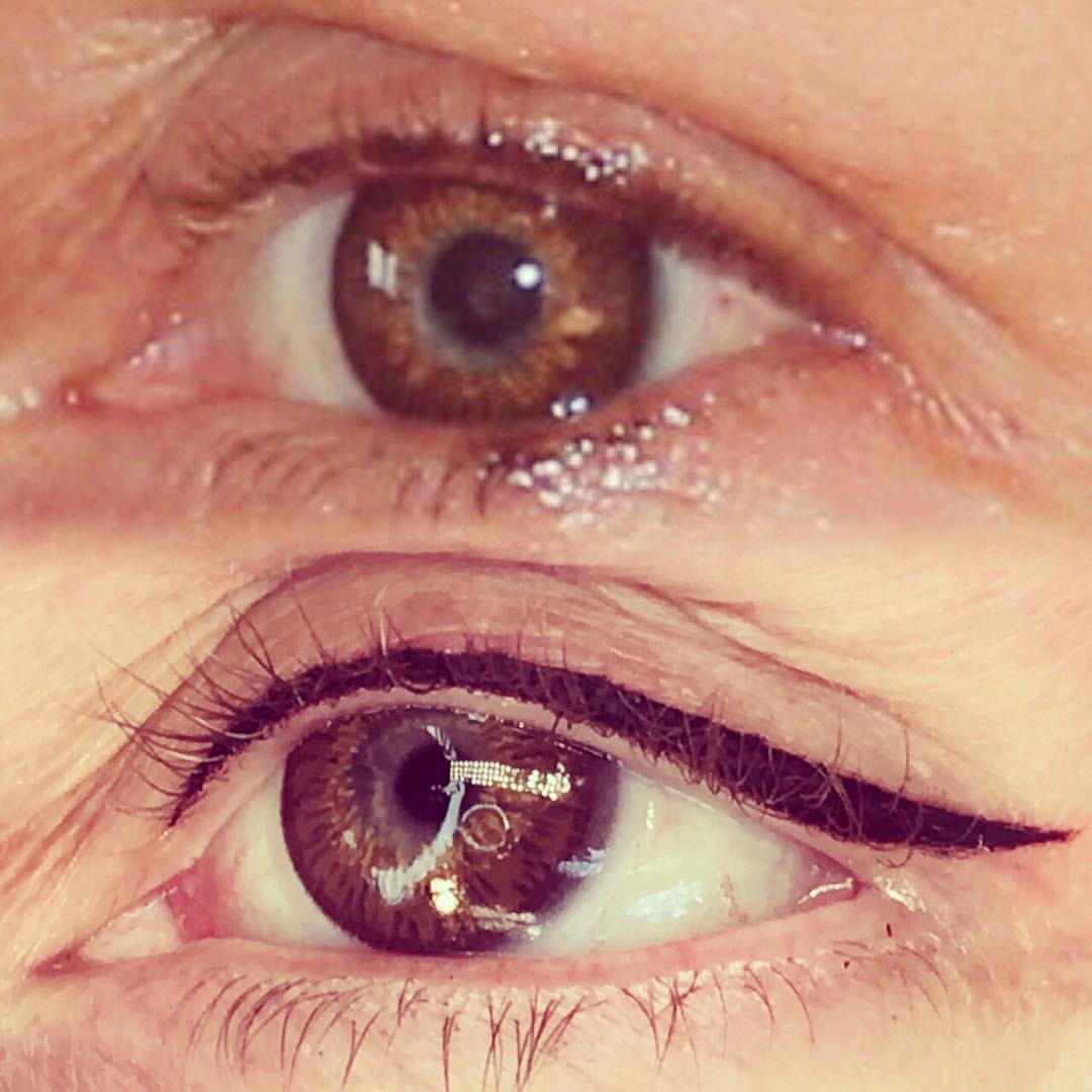 Permanent Eyes before and after image
