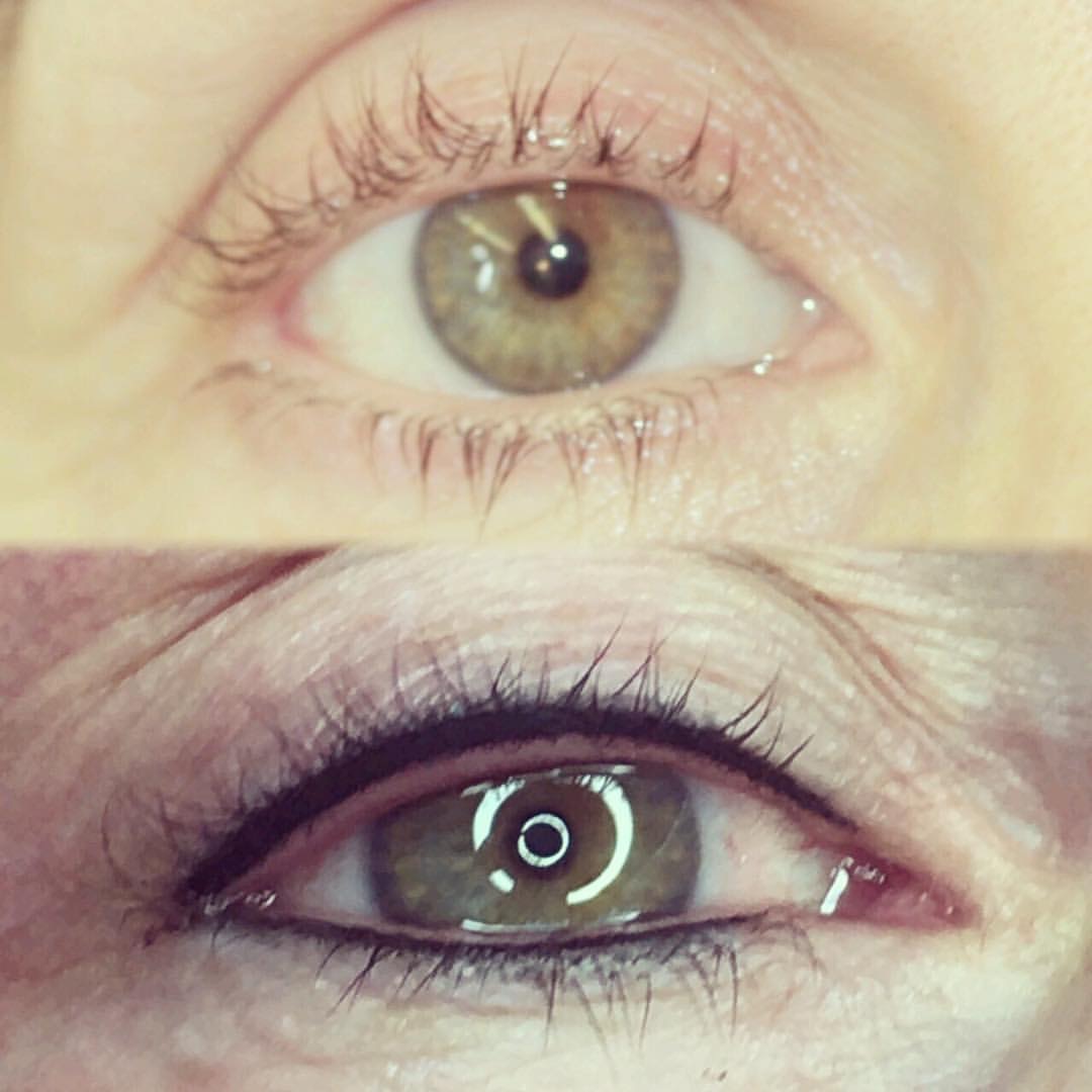 Permanent Eyes before and after image