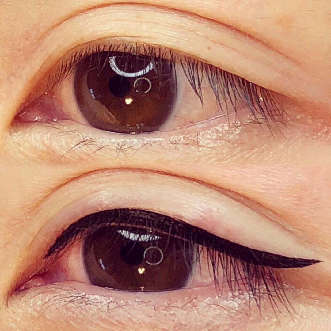 Permanent Eyes before and after image