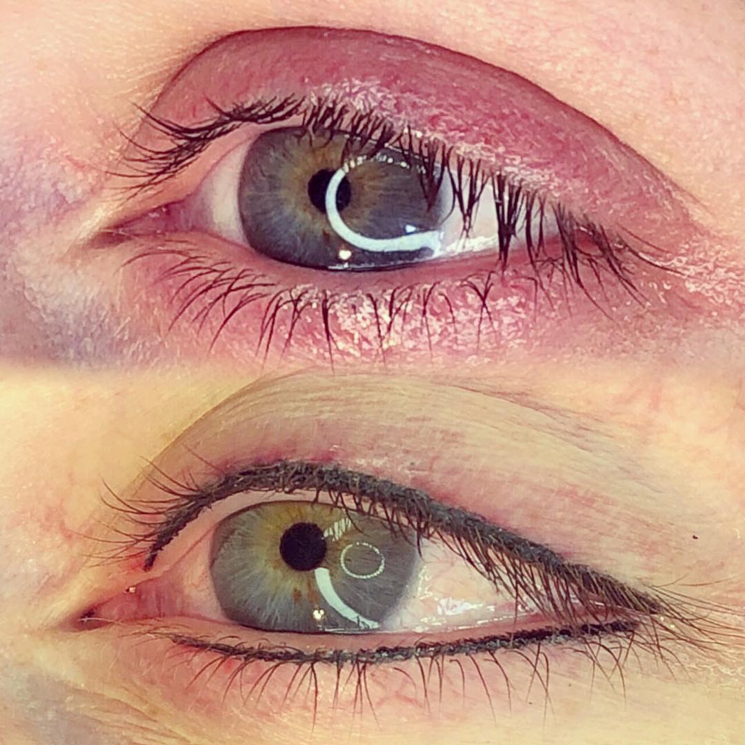 Permanent Eyes before and after image