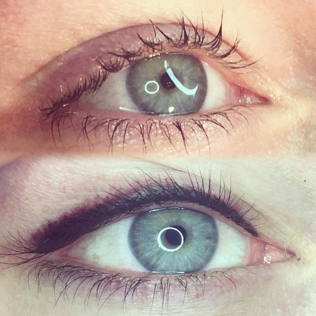 Permanent Eyes before and after image