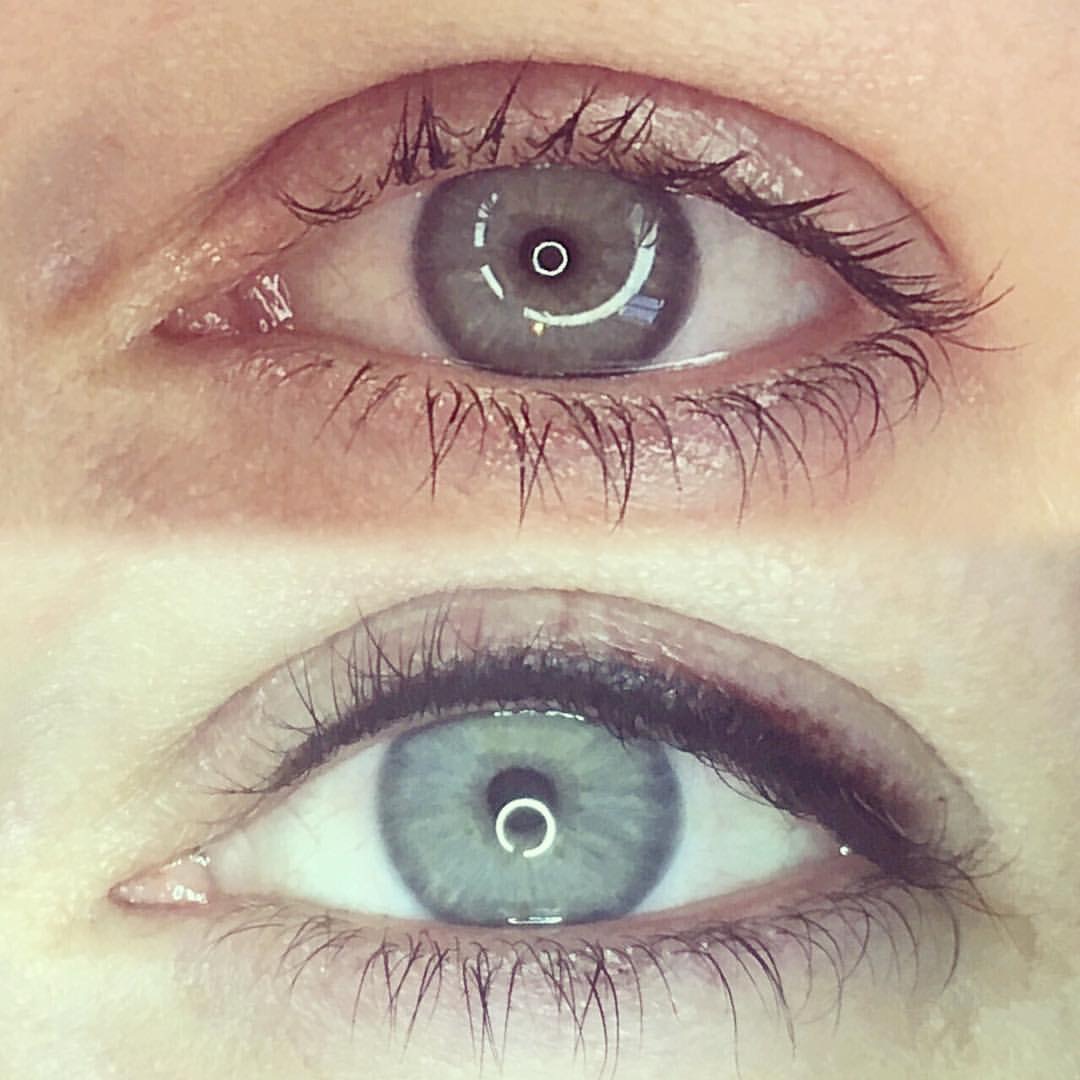 Permanent Eyes before and after image
