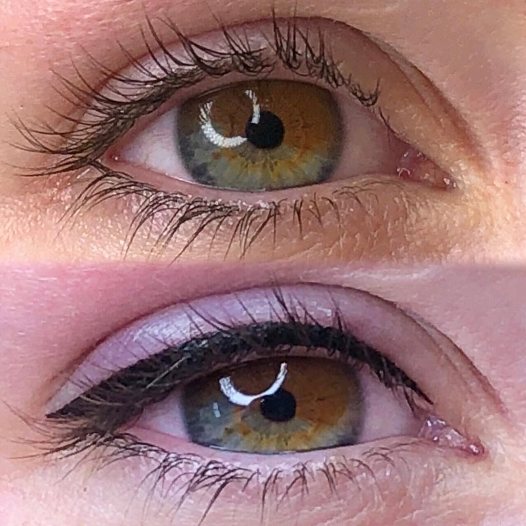 Permanent Eyes before and after image