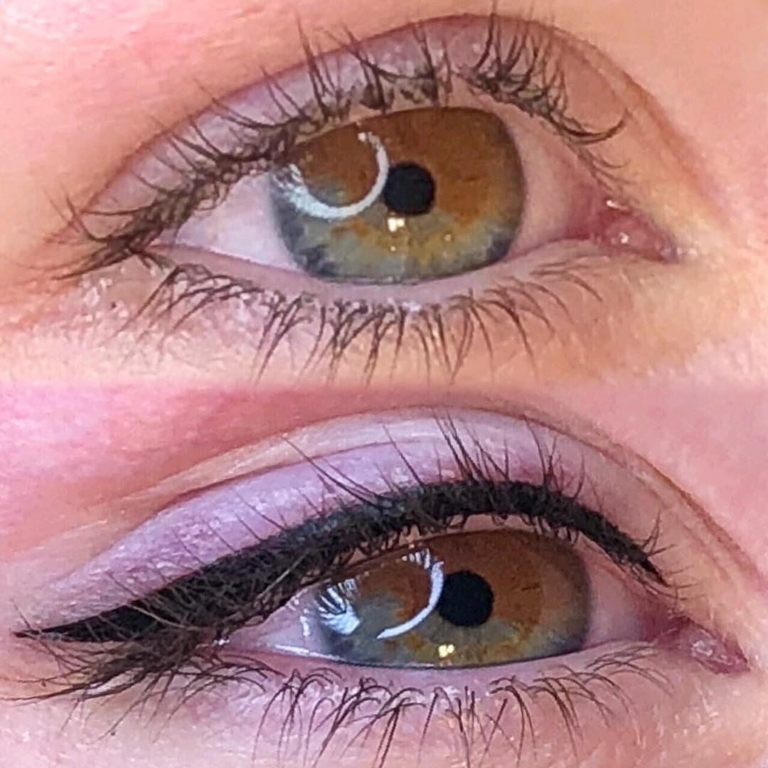 Permanent Eyes before and after image