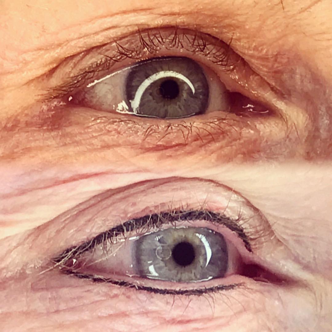 Permanent Eyes before and after image