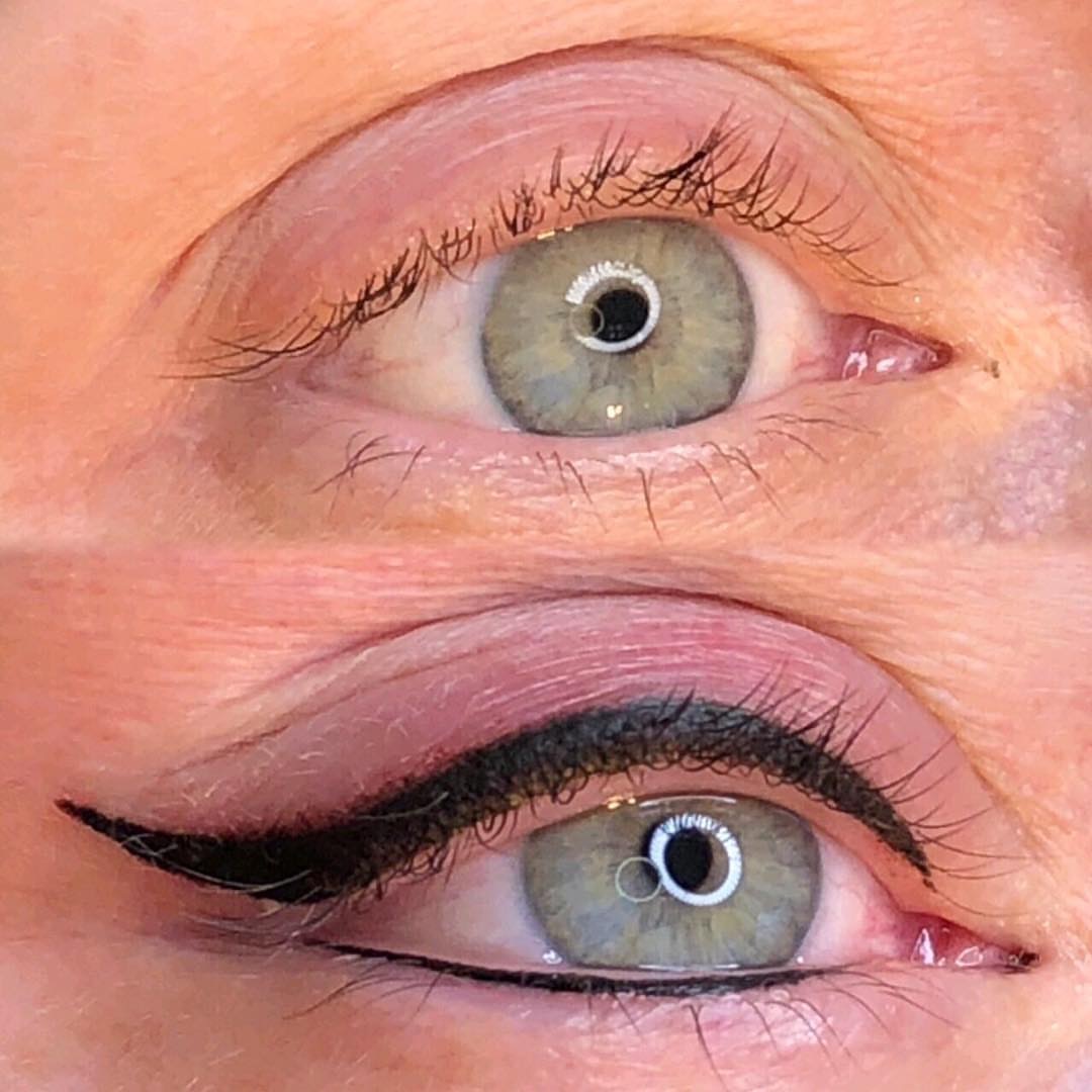 Permanent Eyes before and after image