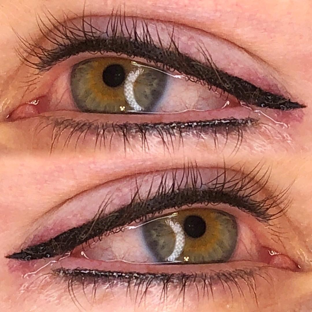Permanent Eyes before and after image