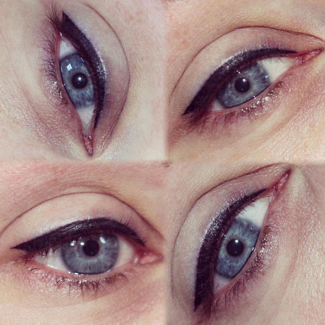 Permanent Eyes before and after image