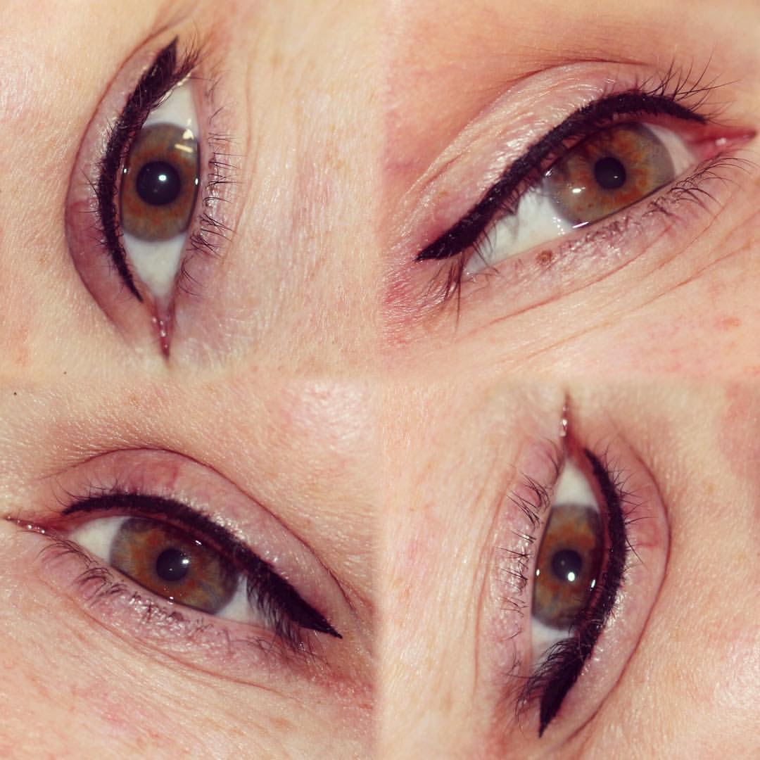 Permanent Eyes before and after image