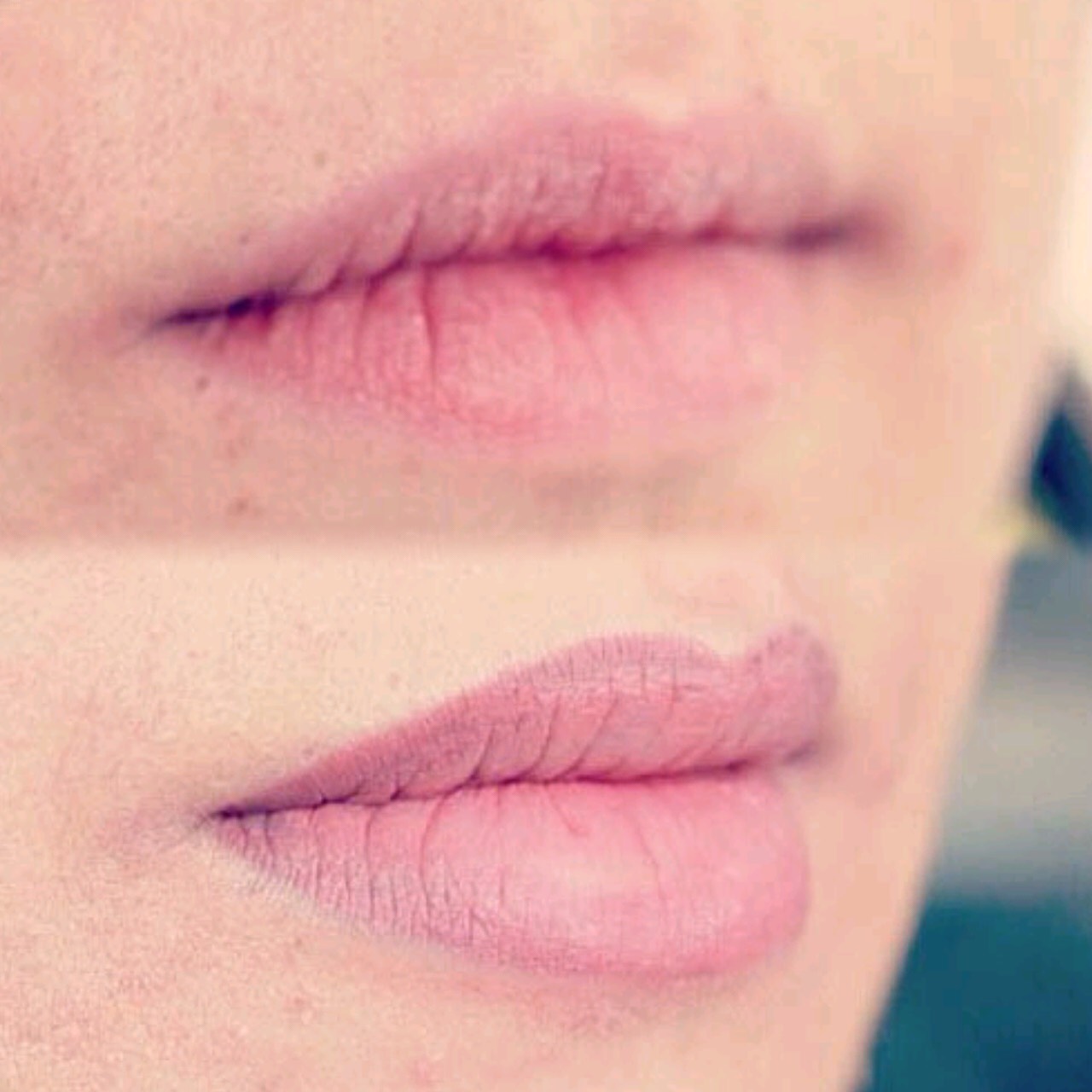 Permanent Lips before and after image