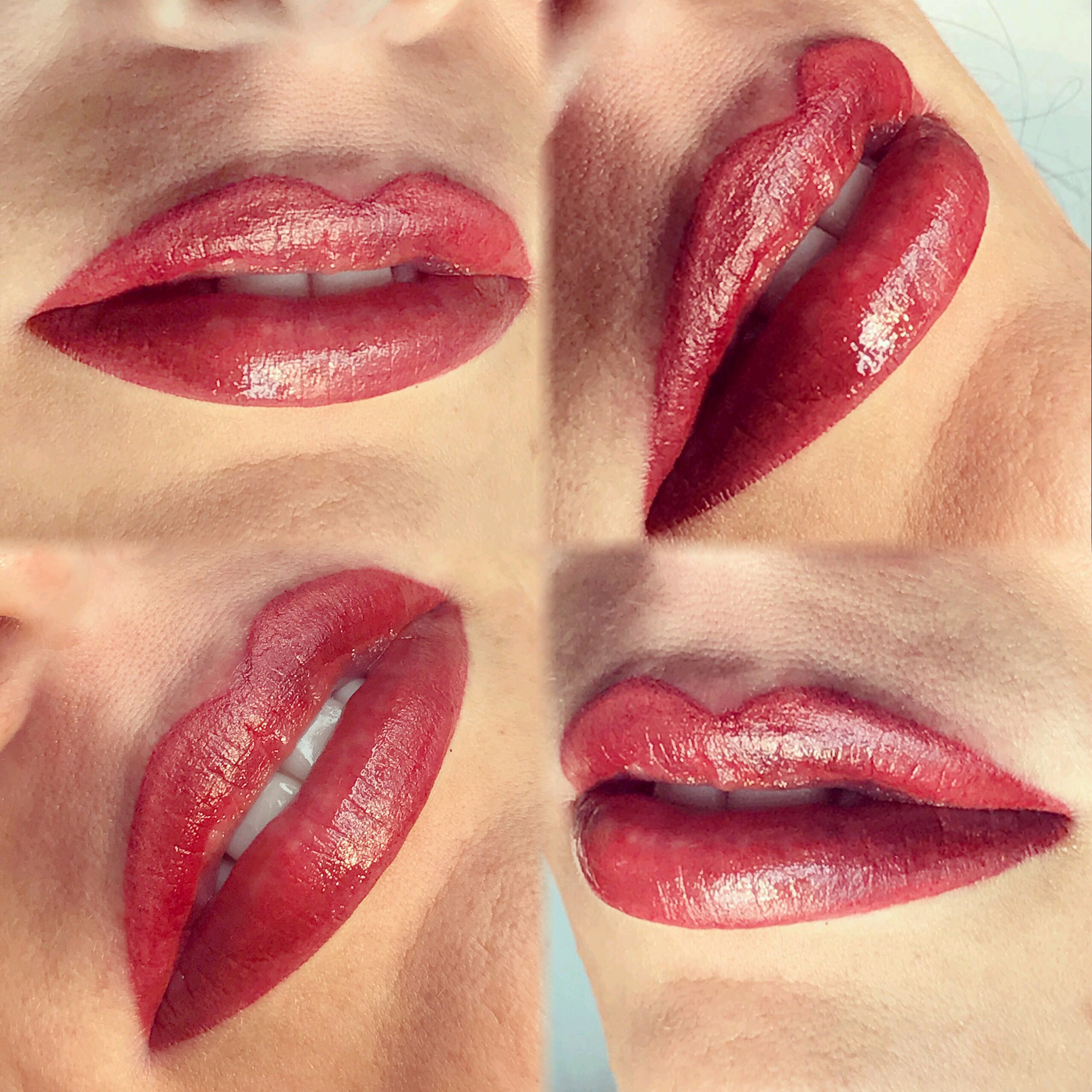 Permanent Lips before and after image