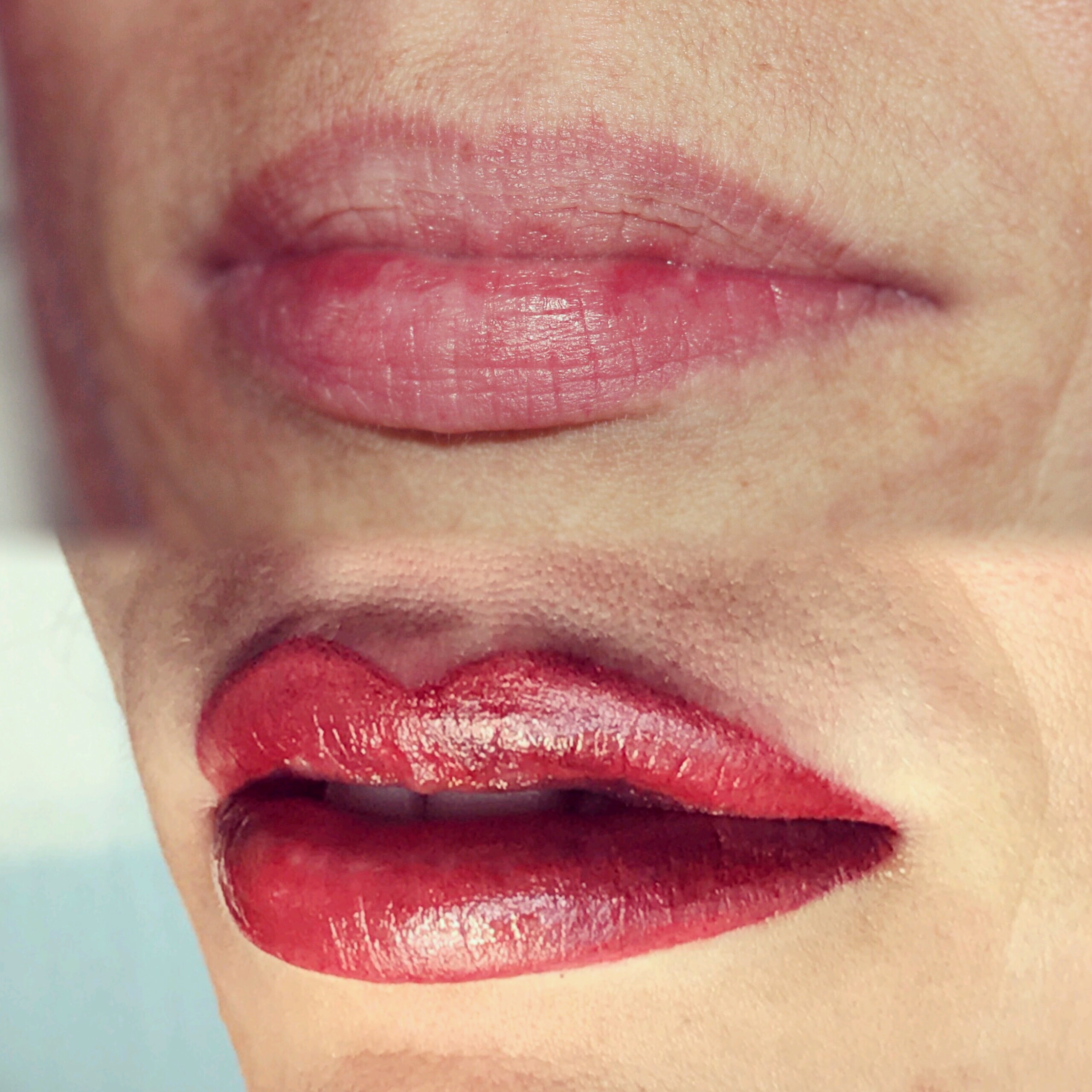 Permanent Lips before and after image