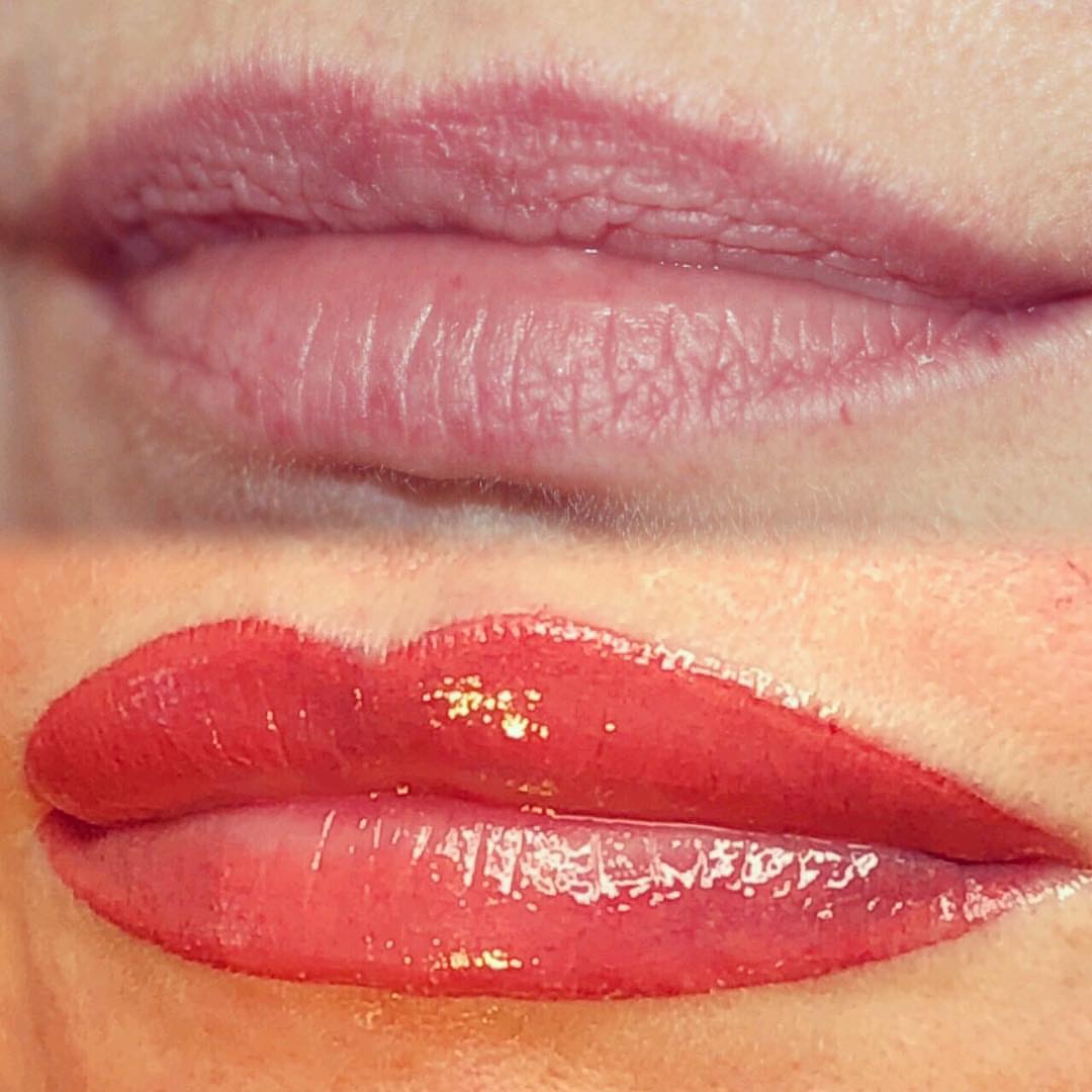 Permanent Lips before and after image
