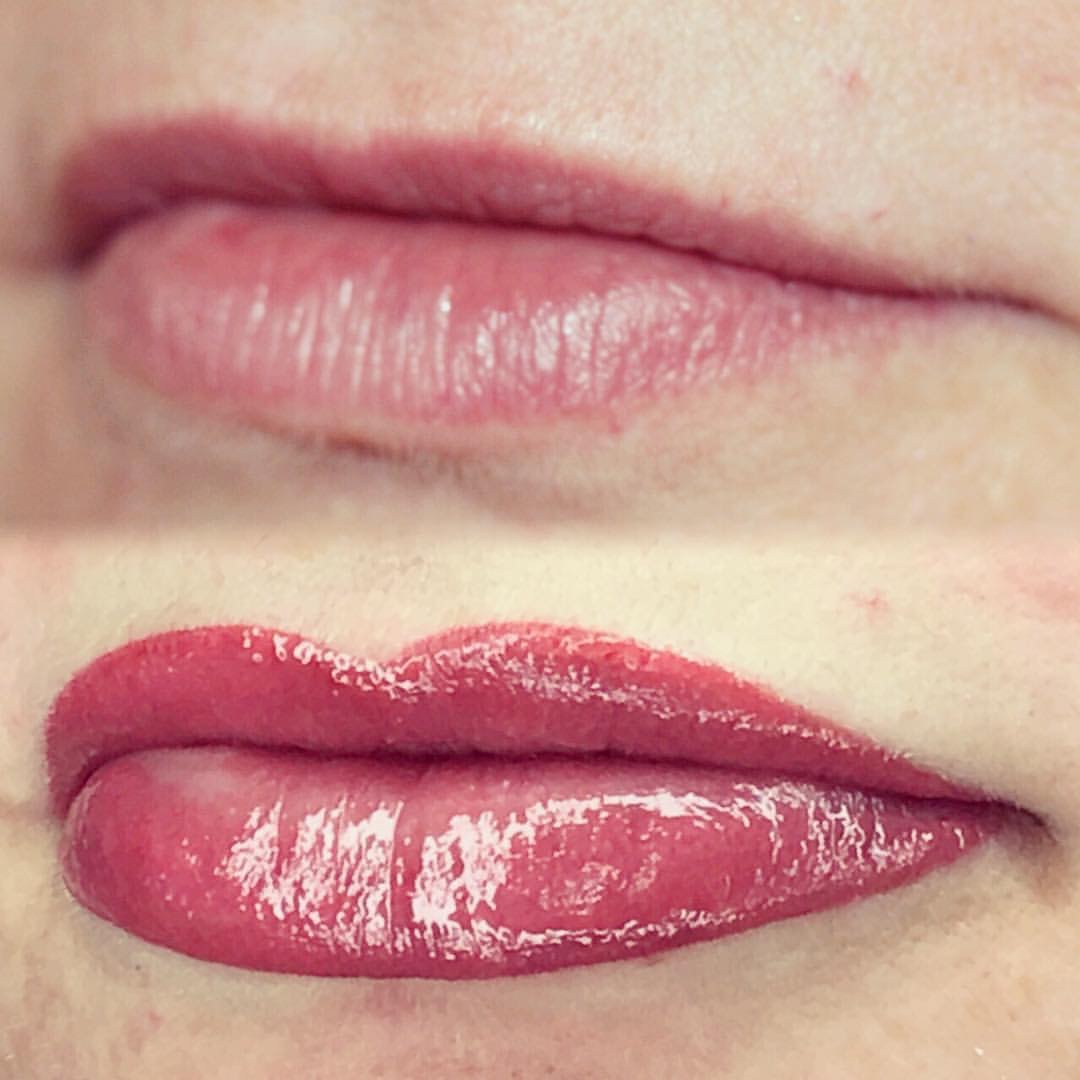 Permanent Lips before and after image