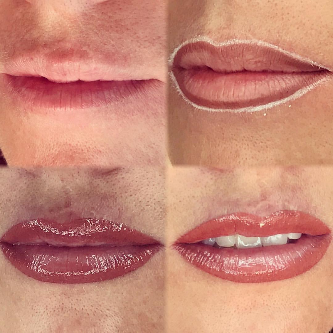 Permanent Lips before and after image