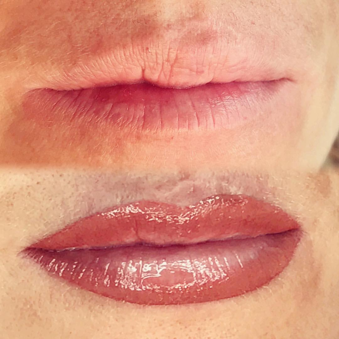 Permanent Lips before and after image