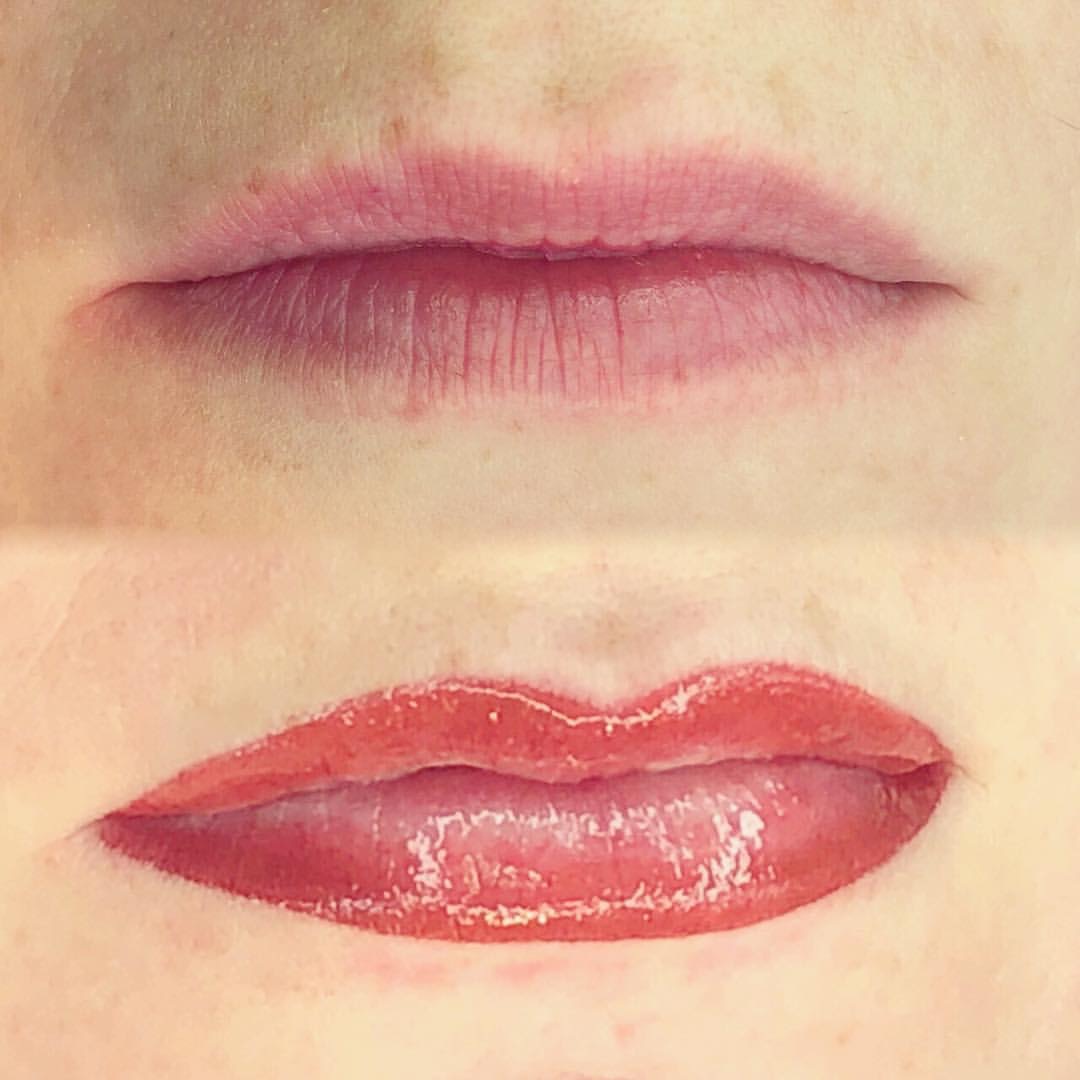 Permanent Lips before and after image