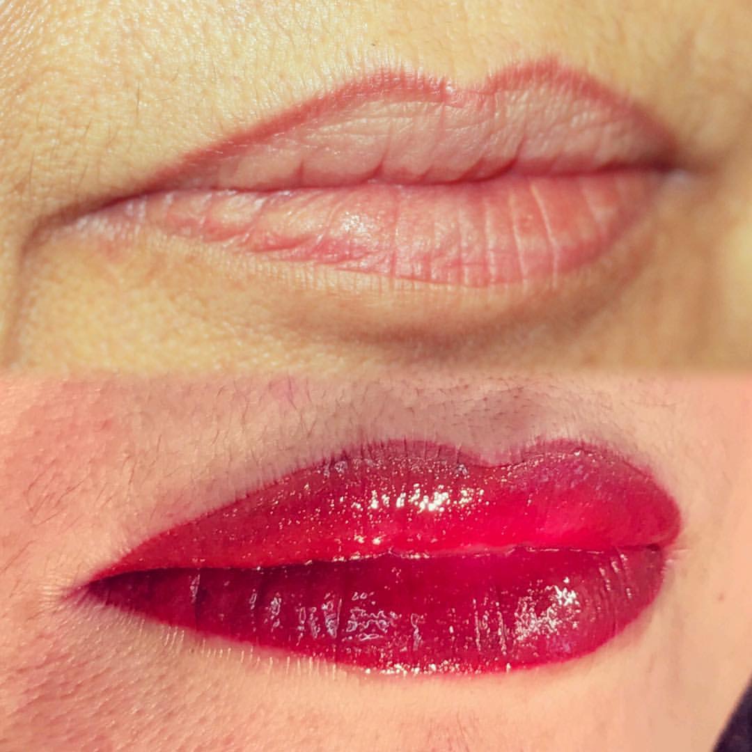 Permanent Lips before and after image