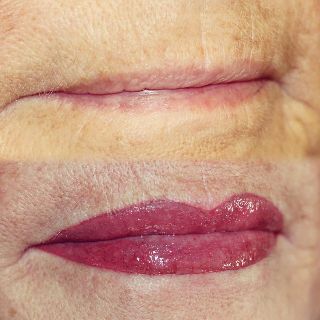 Permanent Lips before and after image