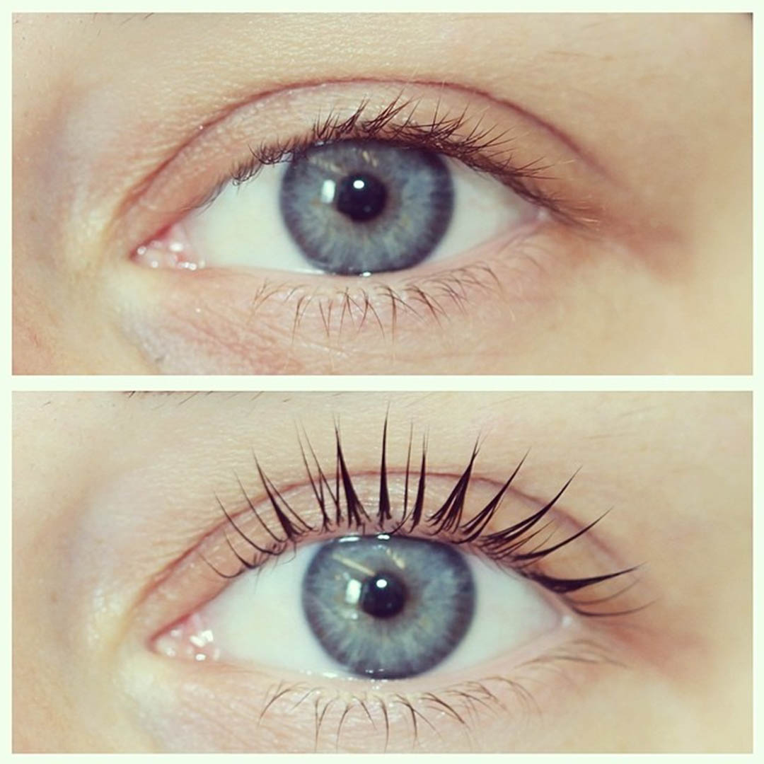LVL Enhance Eyes before and after image