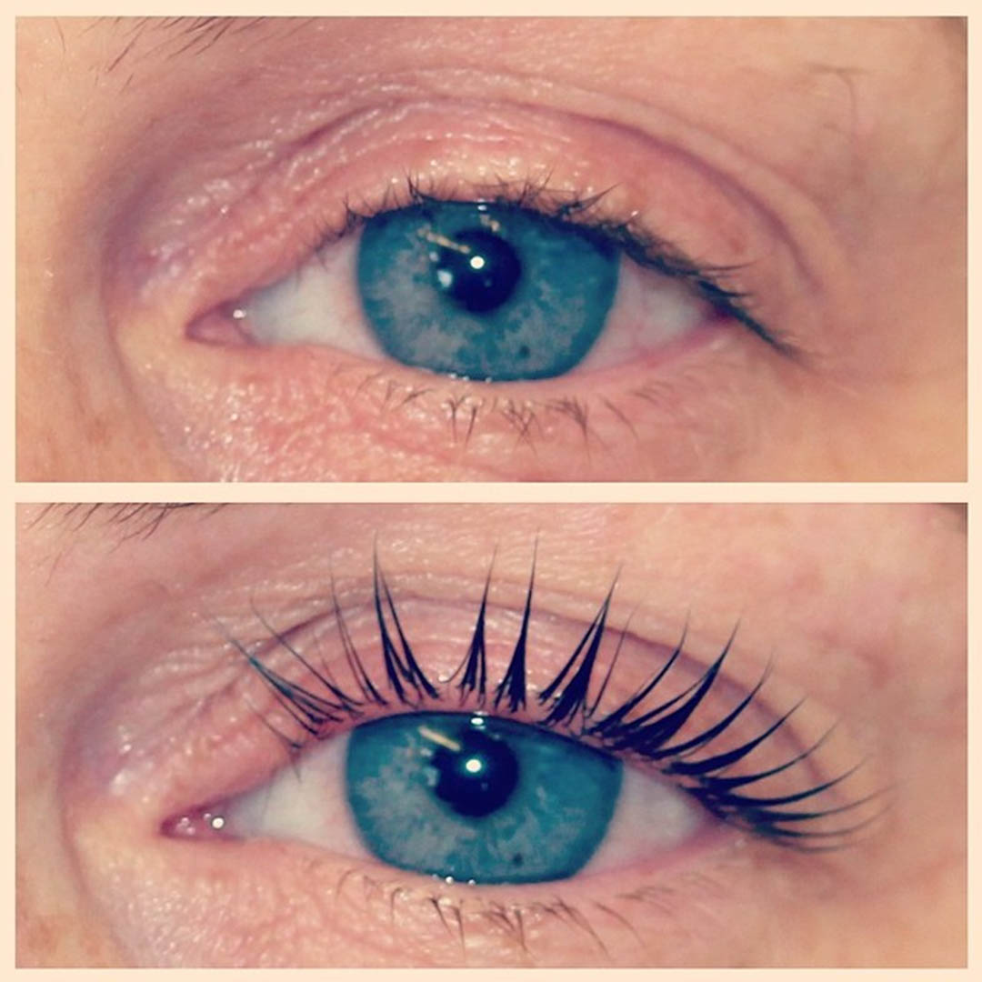 LVL Enhance Eyes before and after image