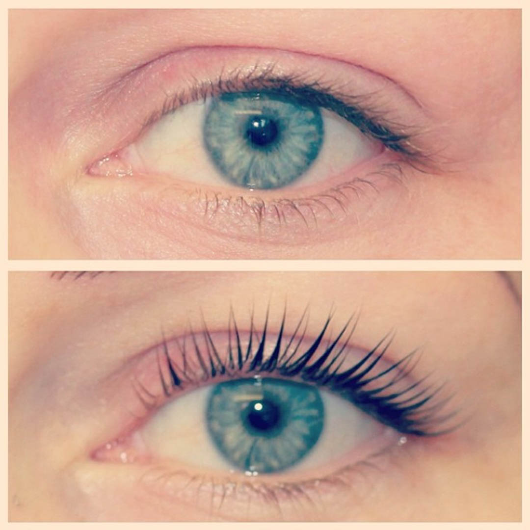 LVL Enhance Eyes before and after image