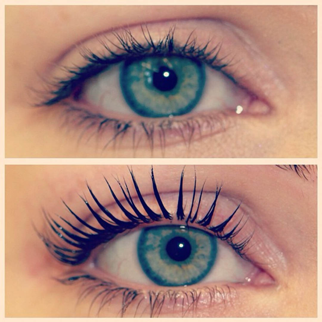 LVL Enhance Eyes before and after image