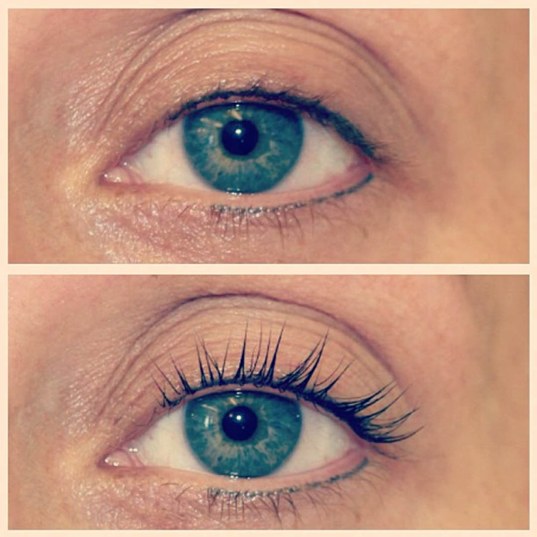 LVL Enhance Eyes before and after image