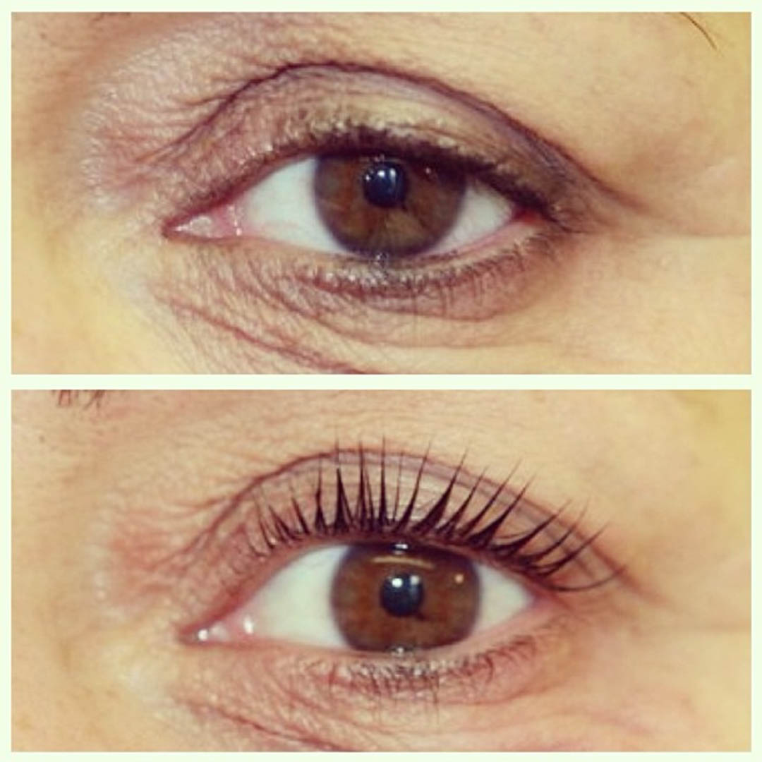 LVL Enhance Eyes before and after image