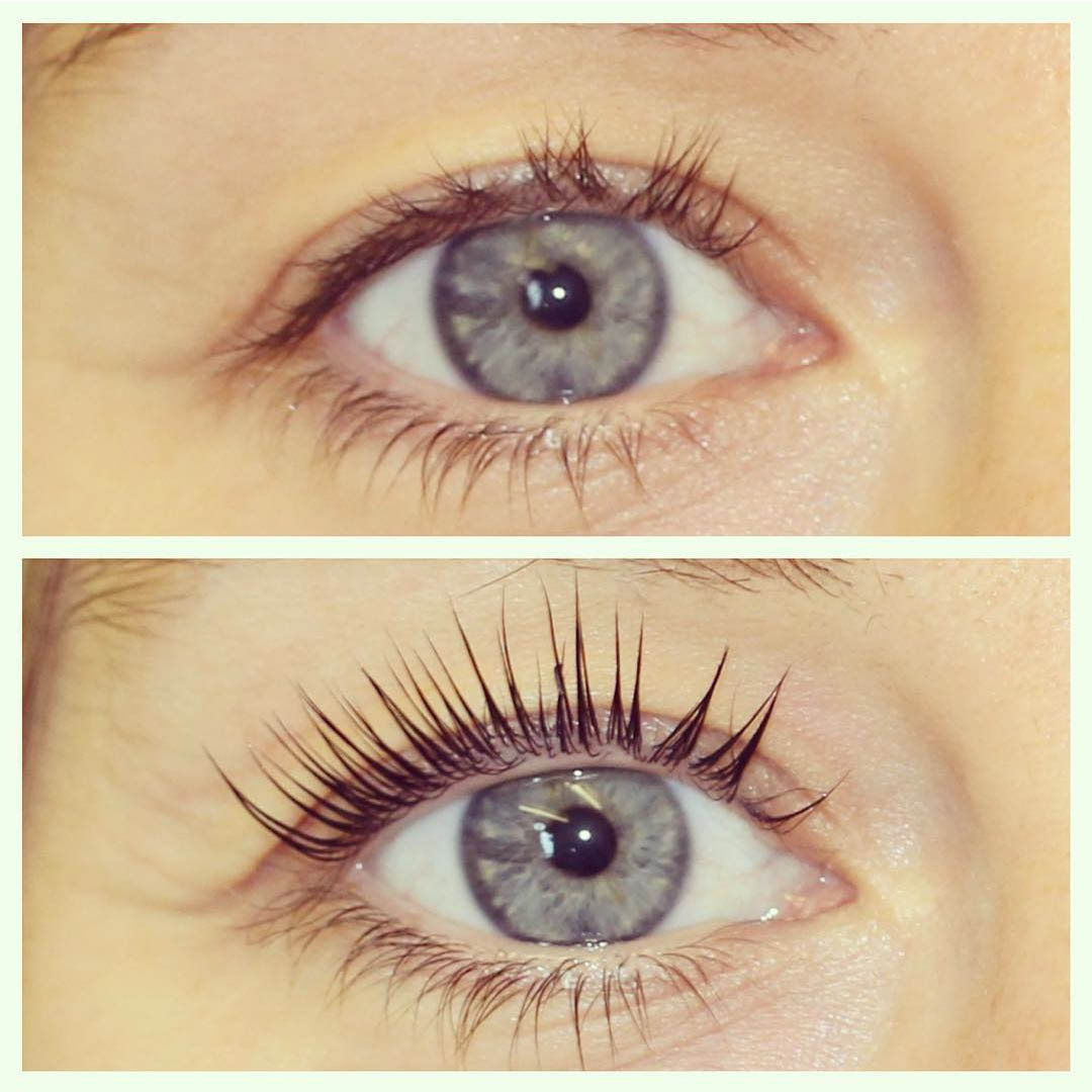LVL Enhance Eyes before and after image