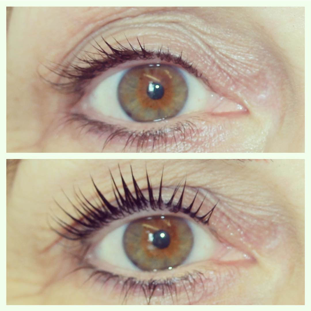 LVL Enhance Eyes before and after image