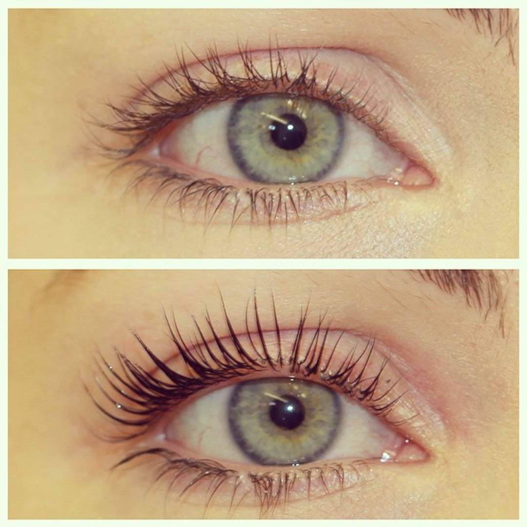 LVL Enhance Eyes before and after image
