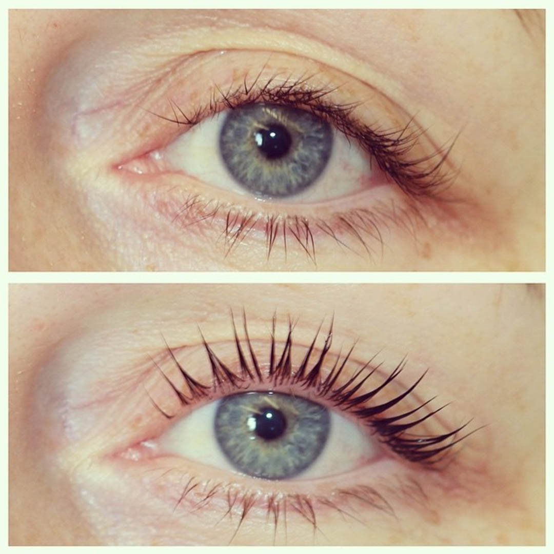 LVL Enhance Eyes before and after image