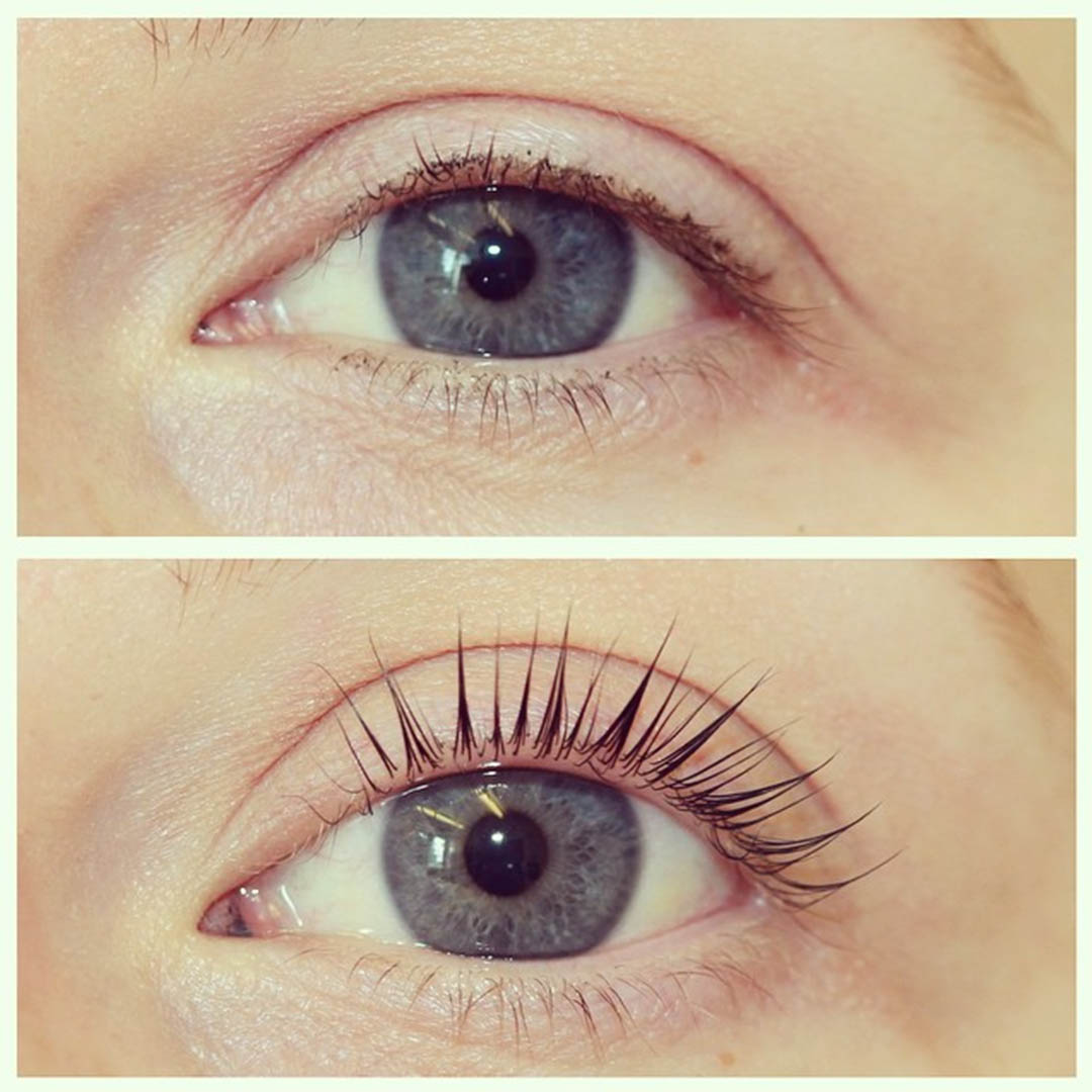 LVL Enhance Eyes before and after image