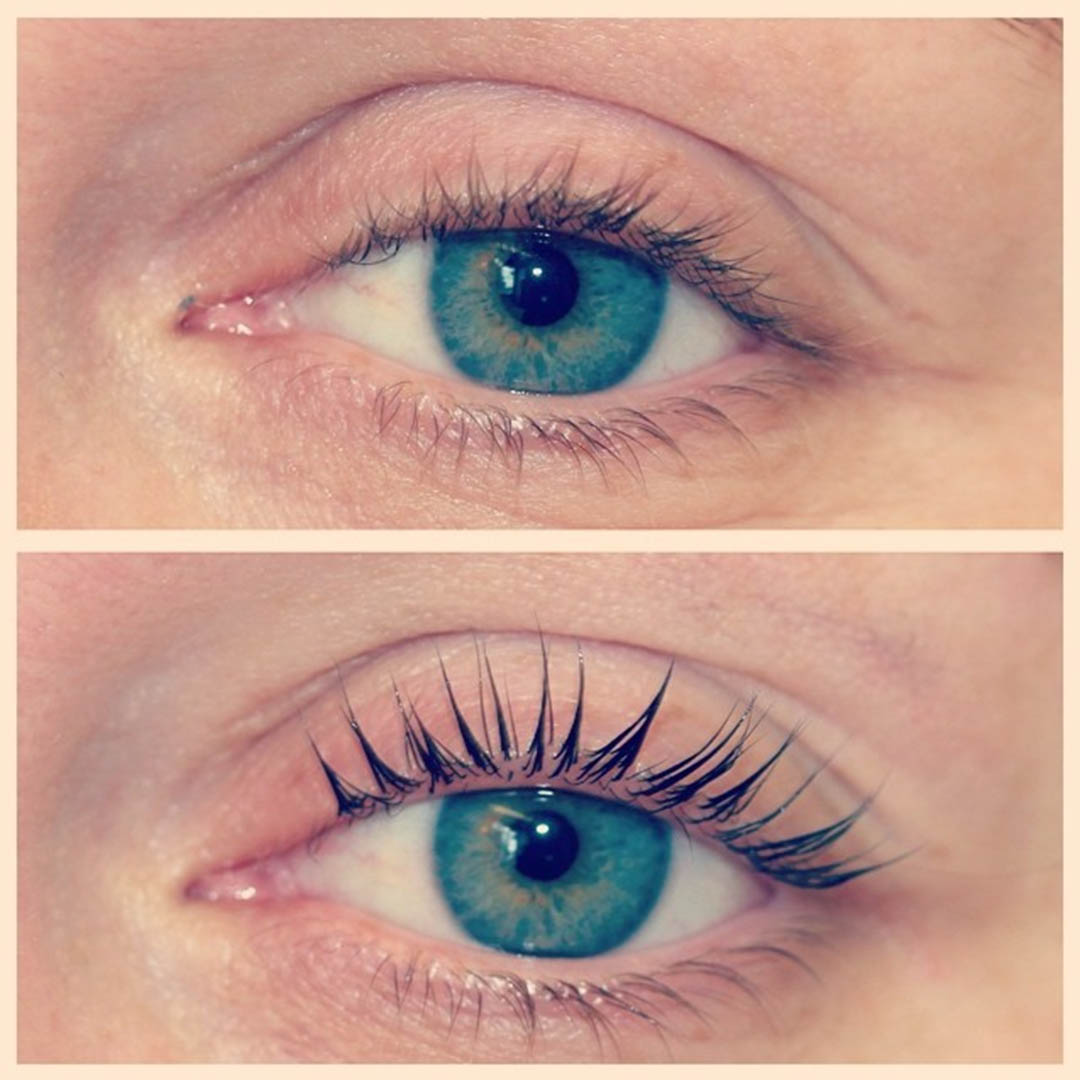 LVL Enhance Eyes before and after image