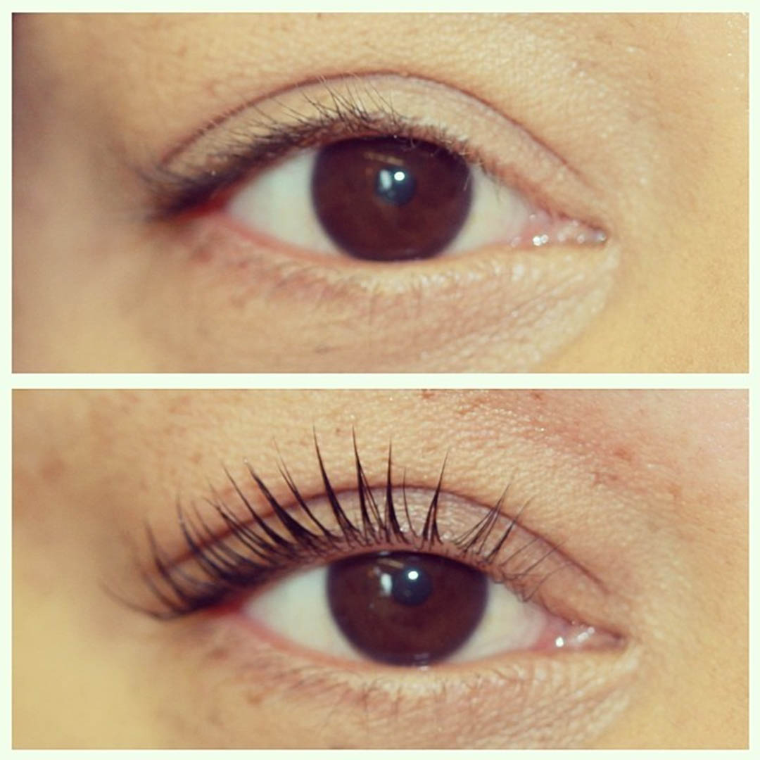 LVL Enhance Eyes before and after image