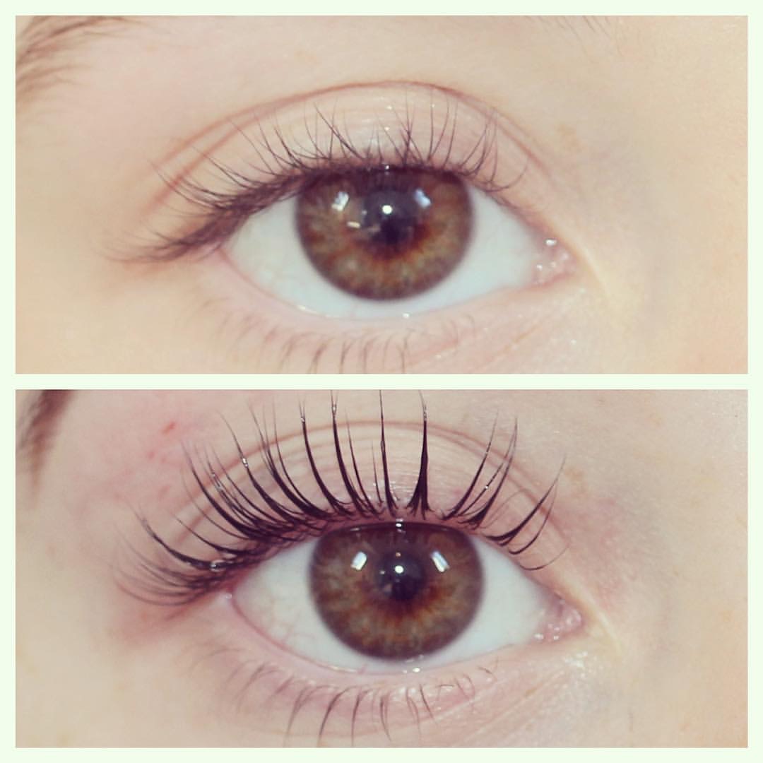 LVL Enhance Eyes before and after image